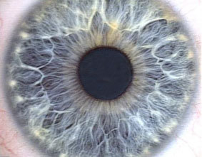 iRiS